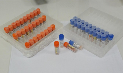 Organophosphorus pesticides residues ELISA KIT Organophosphorus pesticides residues ELISA KIT