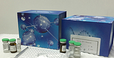 Wilms tumour antigen elisa kit Wilms tumour antigen elisa kit