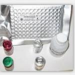 CCP Peptide ELISA kit