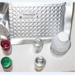Sil-2R/Scd25 ELISA kit