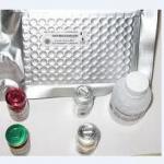 Sil-6R ELISA kit