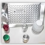 Somatostain ELISA kit