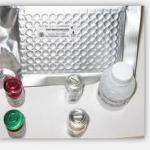 sTNFR-Ⅰ ELISA kit
